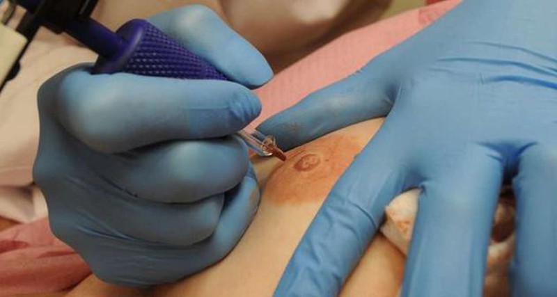 Tatuajes VS Cáncer de mama. Reconstrucción de areolas y pezones por mastectomia.