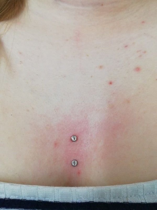Microdermals con joya